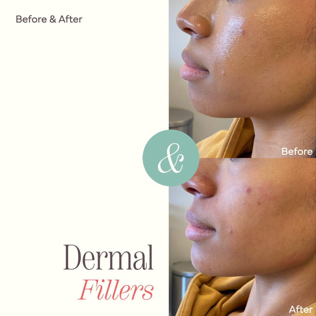 illuma Advanced Aesthetics 2023 | 4 | Branding, digital marketing, web design and development by Brent Thelen Design • BTD